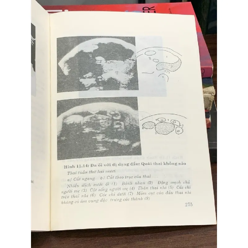 Siêu âm ổ bụng – Hướng dẫn thực hành – J. Tabory; dịch: BS. Nguyễn Trung Hiếu 560831