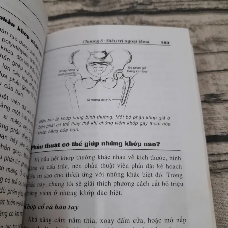 Sách Y-Bệnh Viêm khớp . Bác sỹ Gene G. Hunder. Bác Sỹ Lan Phương biên dịch 705129