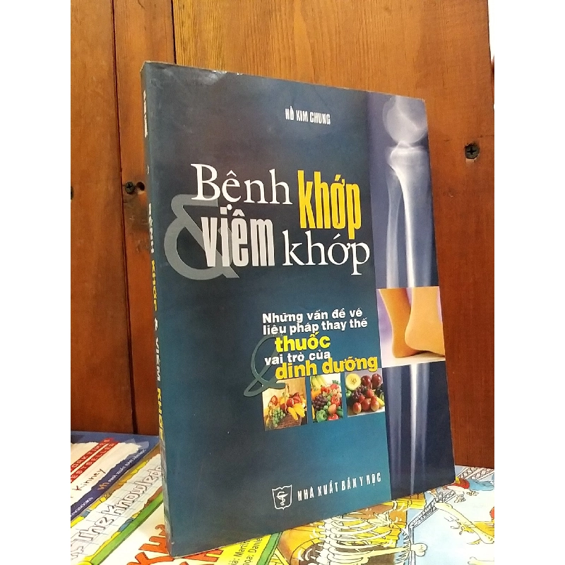 Bệnh khớp và viêm khớp - Hồ Kim Chung 739272