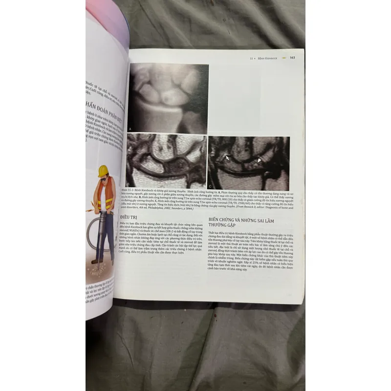 Atlas y khoa Hội chứng đau hiếm gặp  715543
