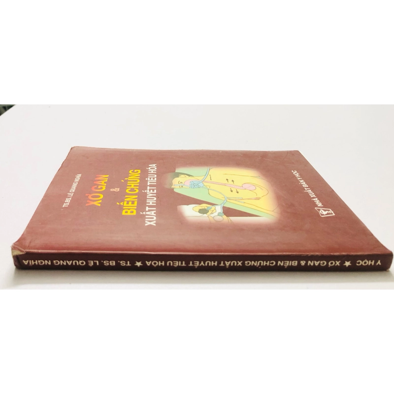 XƠ GAN & BIẾN CHỨNG XUẤT HUYẾT TIÊU HOÁ - 180 trang, nxb: 2001 360578