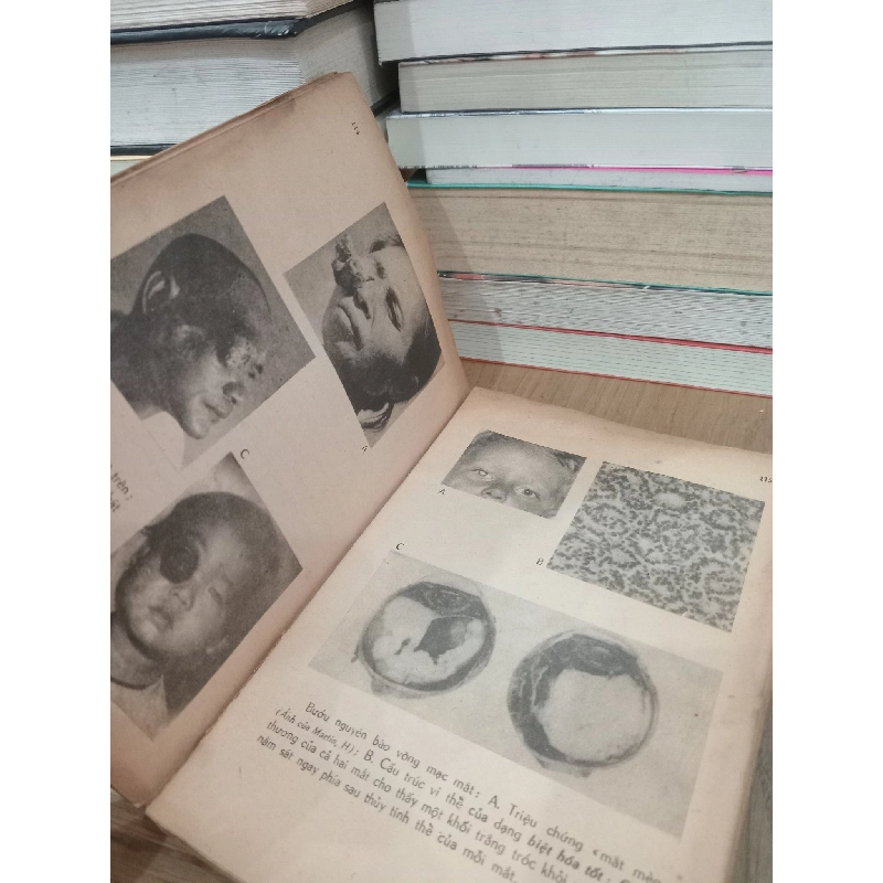 Ung thư học lâm sàng - Nguyễn Chấn Hùng 730890