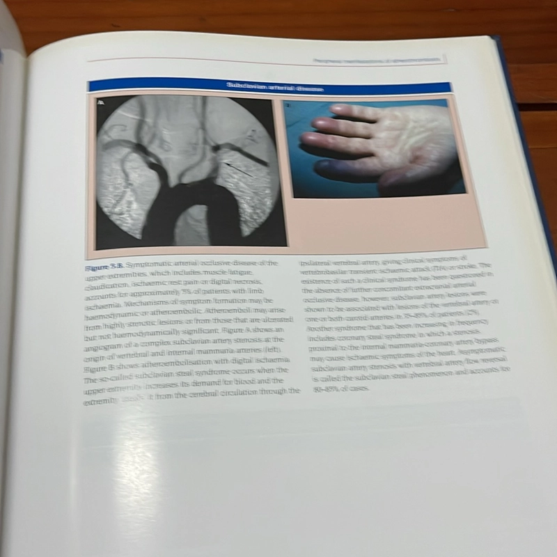 PICTURE BOOK Atlas of atherothrombosis 536358