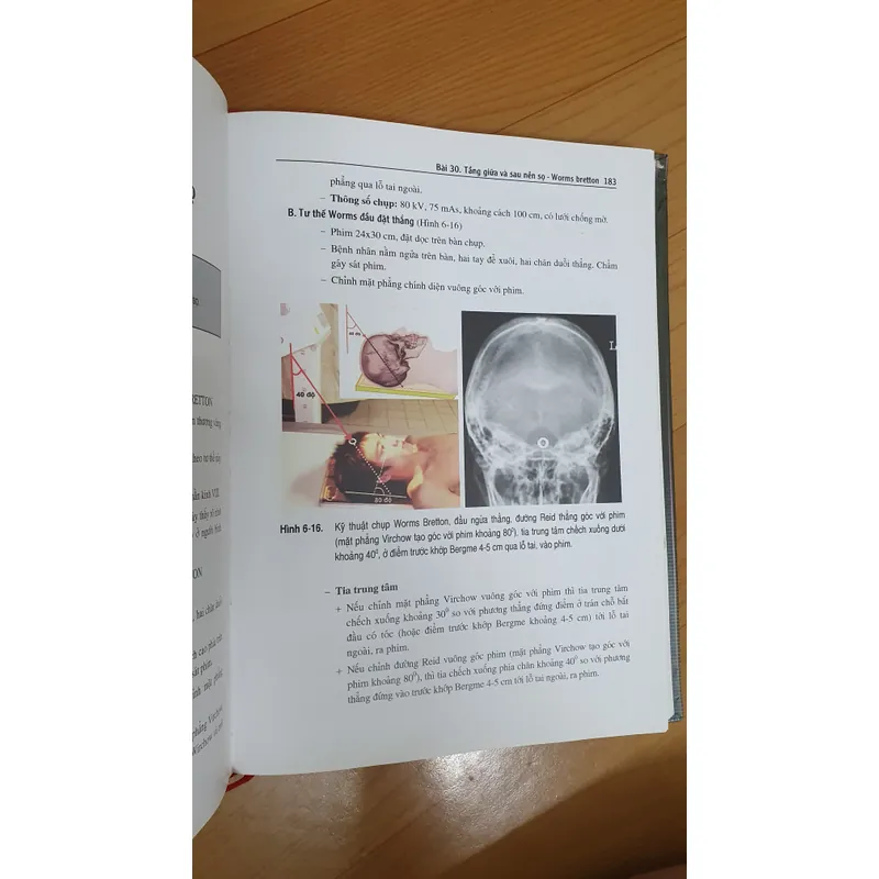 KỸ THUẬT CHỤP X QUANG 738448