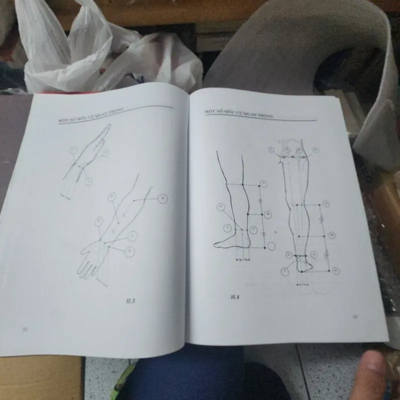 Tăng huyết áp các chứng liên đới -  chuyên khoa châm cứu 975372