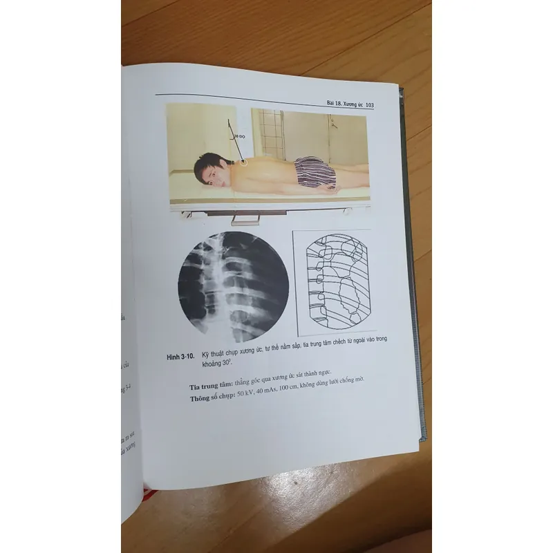 KỸ THUẬT CHỤP X QUANG 738448