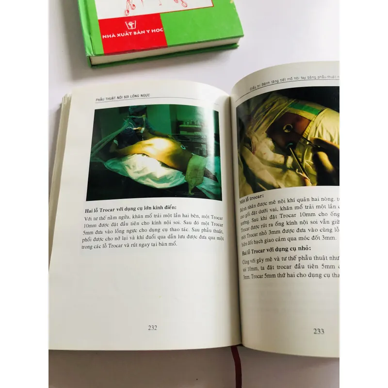 PHẪU THUẬT NỘI SOI LỒNG NGỰC  675226