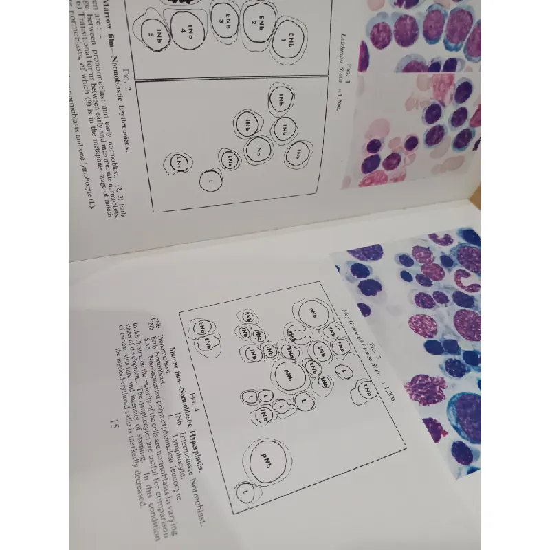 Atlas of Haematology - McDonald, Dodds, Cruickshank 575853