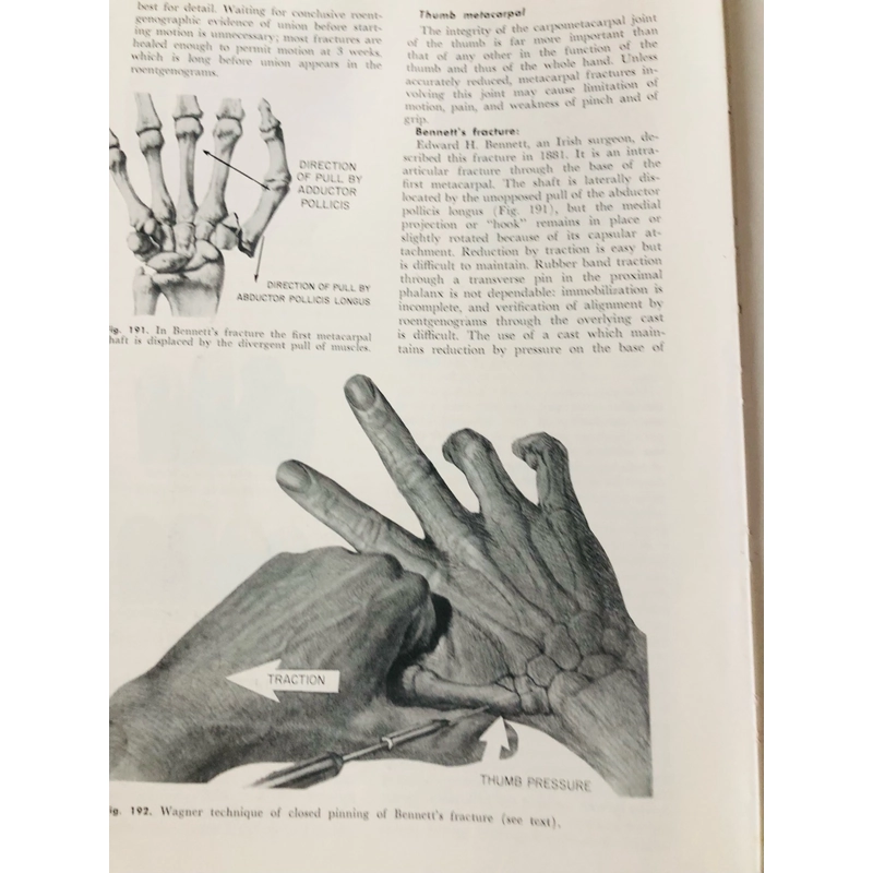 CAMPBELL’S OPERATIVE ORTHOPAEDICS ( chỉnh hình phẫu thuật) 470880
