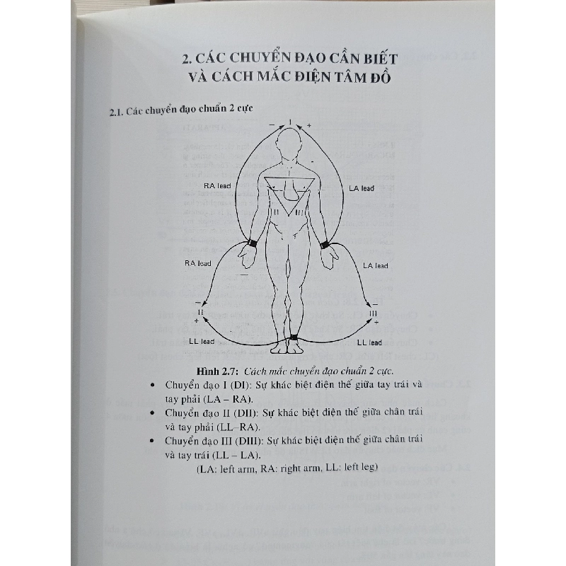 Loạn nhịp tim trong lâm sàng: Chẩn đoán và điều trị - PGS.TS.BS. Hoàng Quốc Hòa 1006481