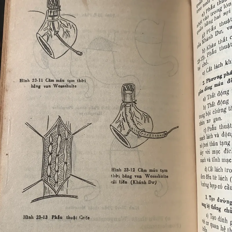 Bài giảng bệnh học ngoại khóa tập 1 - 2, lưu hành nội bộ 709608