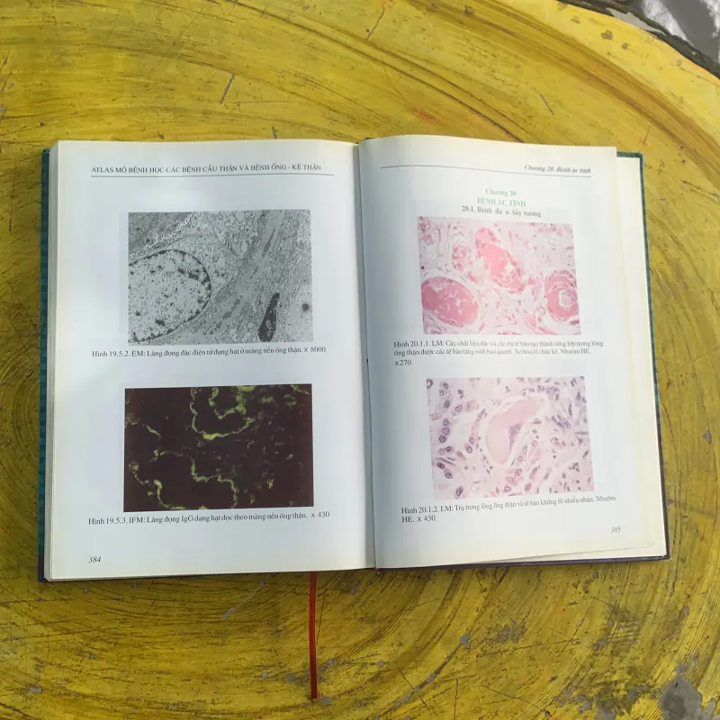 ATLAS MÔ BỆNH HỌC CÁC BỆNH CẦU THẬN & BỆNH ỐNG - KẼ THẬN 1009009