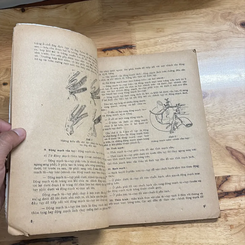 II Sách Y: Bệnh Học Ngoại _ Tuỵ Lách - GS. Nguyễn Đức Ninh - 1991 682294