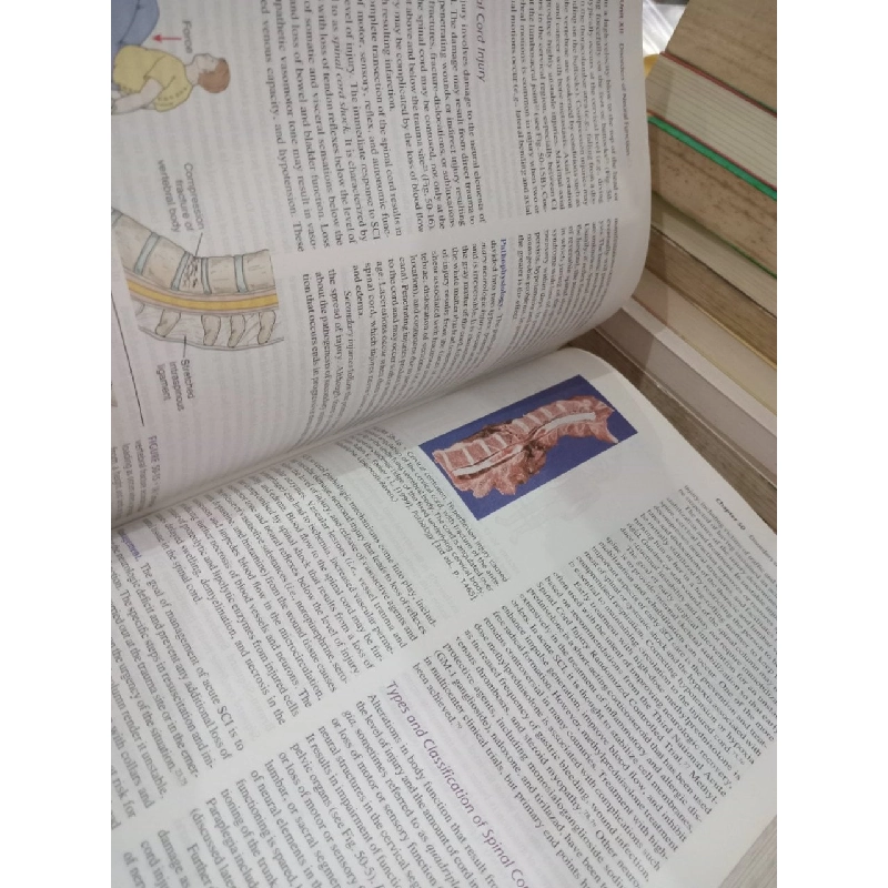 Pathophysiology: Concepts of Altered Health States - C. M. Porth, G. Matfin 792226