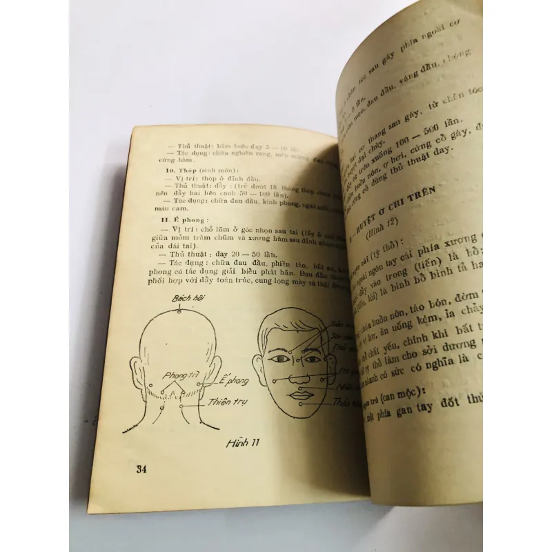 XOA BÓP TRẺ EM 1986 796548