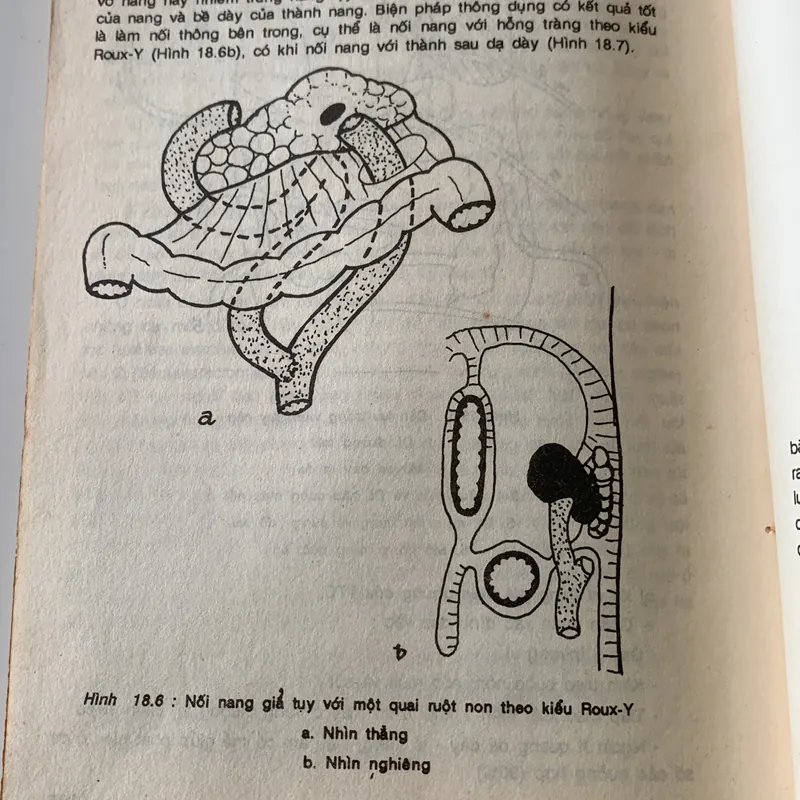 Bài giảng điệu trị học ngoại khoa, Trương Công Trung-Nguyễn Đình Hối 710631