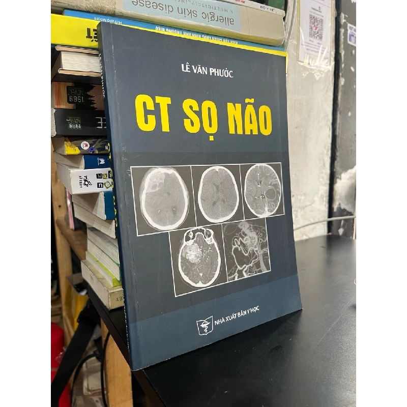 CT sọ não - Lê Văn Phước 738449