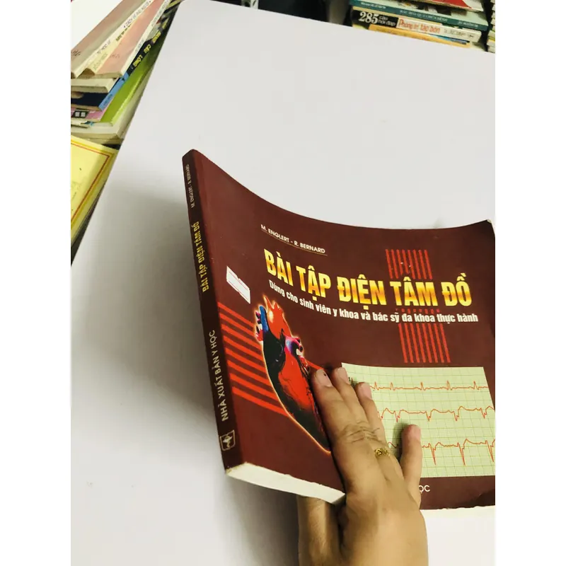 BÀI TẬP ĐIỆN TÂM ĐỒ (M. Englert – R. Bernard) 598068