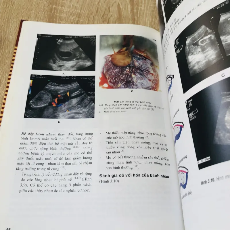 SIÊU ÂM SẢN KHOA THỰC HÀNH  974763