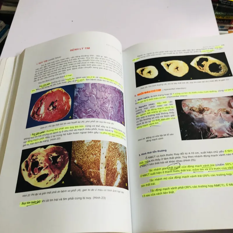 BÀI GIẢNG LÝ THUYẾT GIẢI PHẪU BỆNH  780441