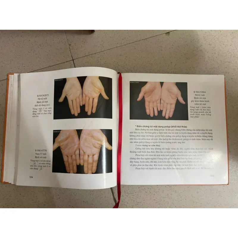 Chuẩn đoán bệnh qua vân tay 585366