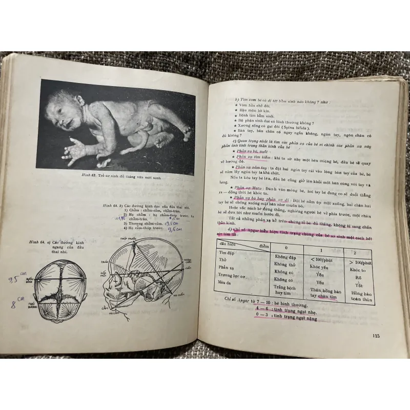 Bài giảng sản phụ khoa 2 tập - 1990, sách khổ lớn; khoảng 700 trang  1006351