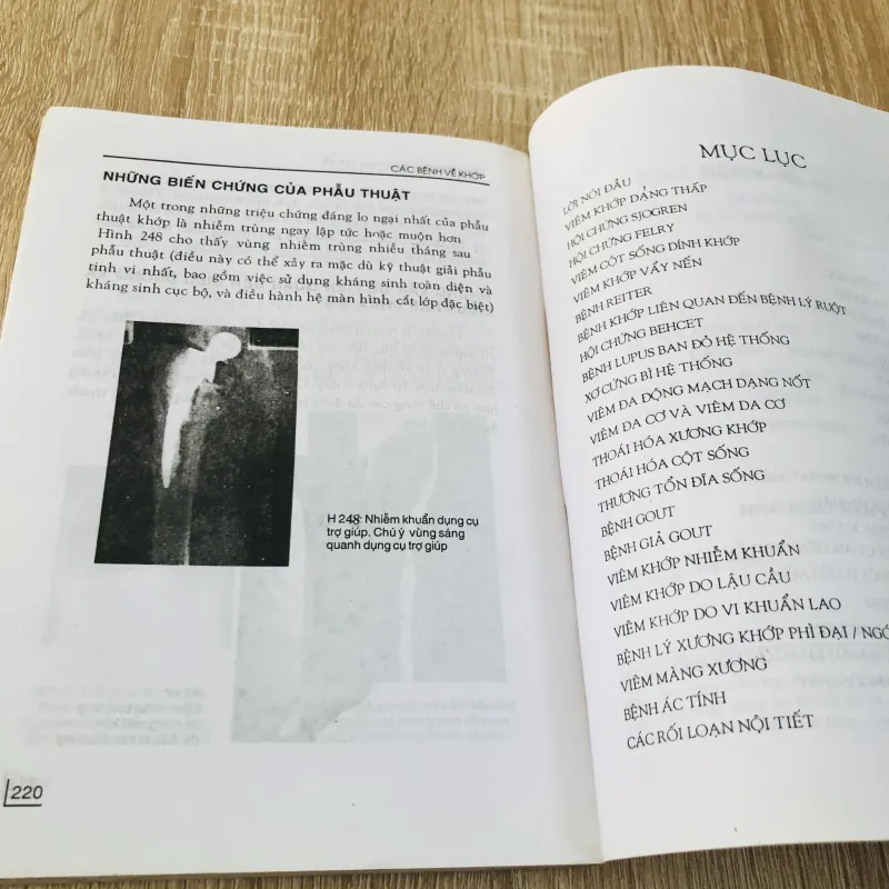 CÁC BỆNH VỀ KHỚP 968662