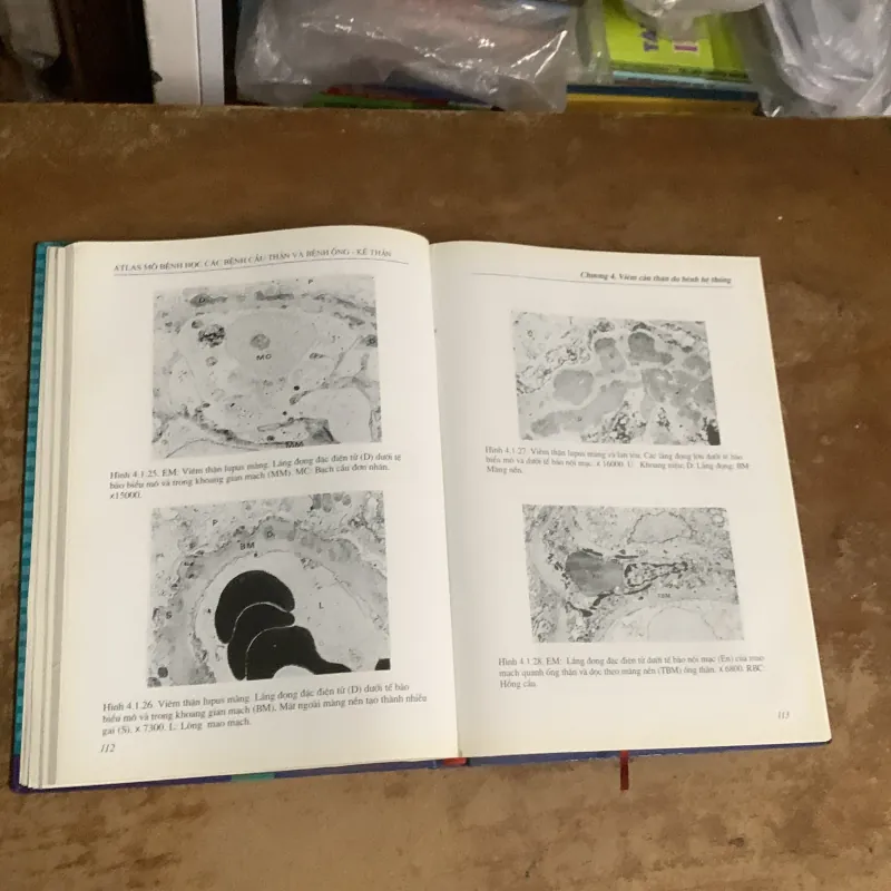 ATLAS MÔ BỆNH HỌC CÁC BỆNH CẦU THẬN & BỆNH ỐNG - KẼ THẬN 935201