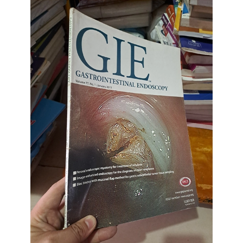 GIE Gastrointestinal Endoscopy volume 77 no 1 1/2013 HCM0808 TẠP CHÍ, THIẾT KẾ, THỜI TRANG Rebooks.vn 944341