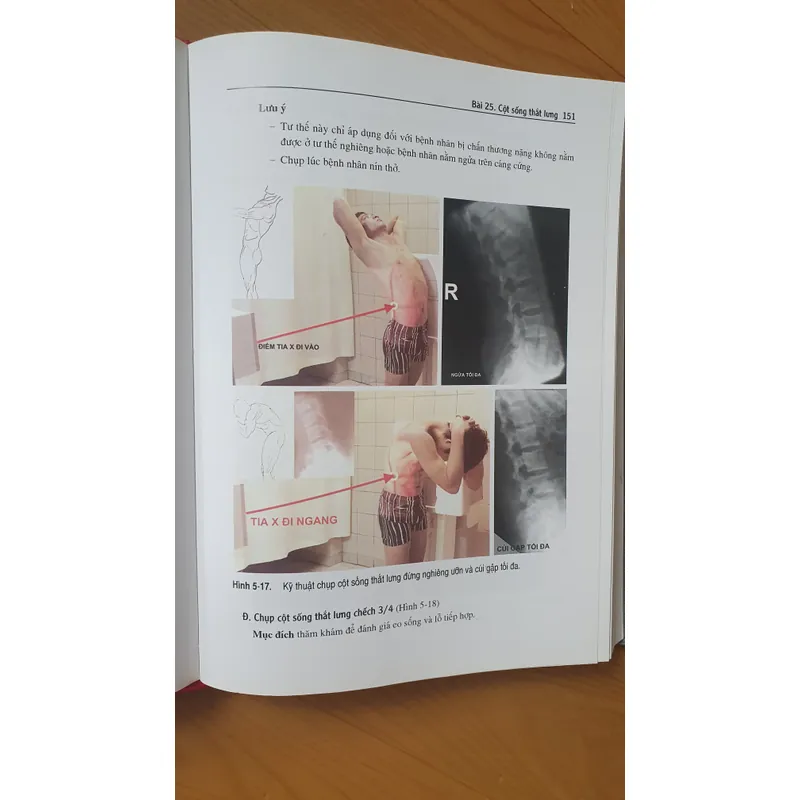 KỸ THUẬT CHỤP X QUANG 738448