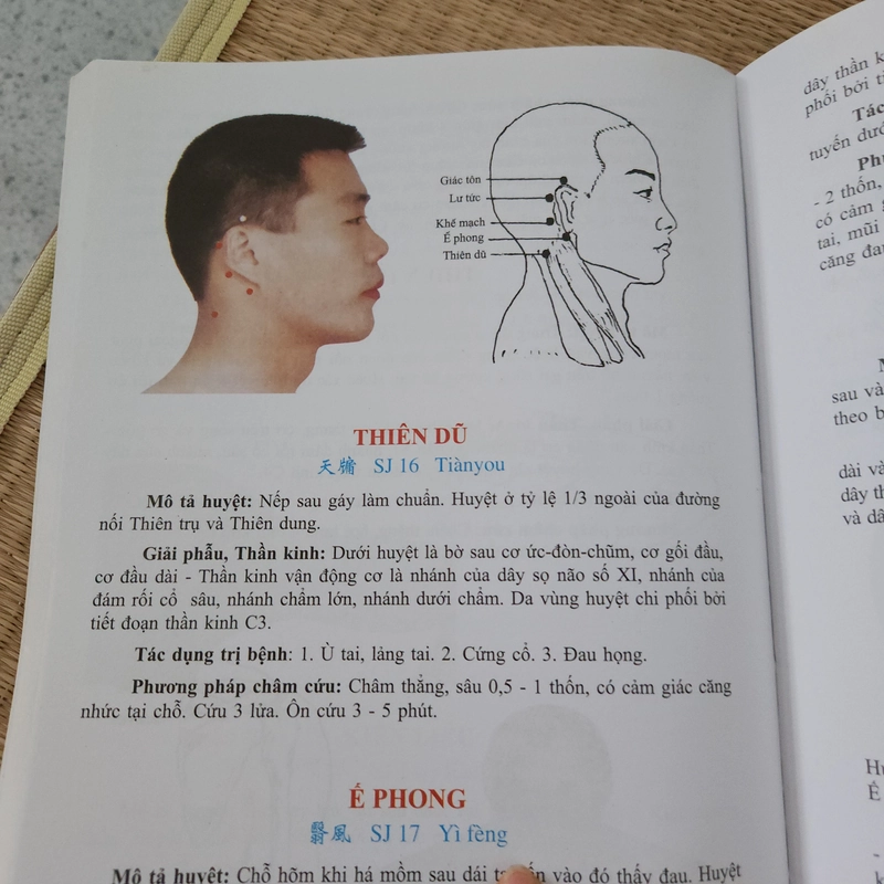 Học châm cứu bằng hình ảnh Lê Quý Ngưu 447079