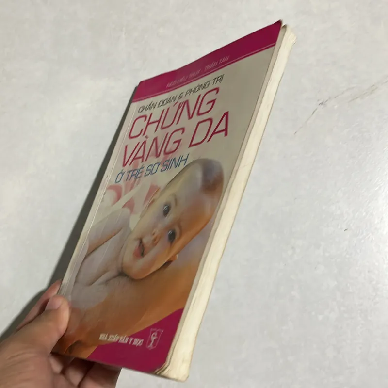 Chẩn đoán & phòng trị chứng vàng da ở trẻ sơ sinh 589623
