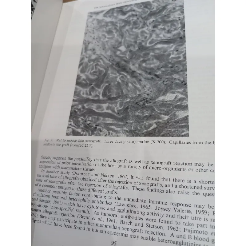 Transactions of the fourth international congress of plastic and reconstructive surgery 556684