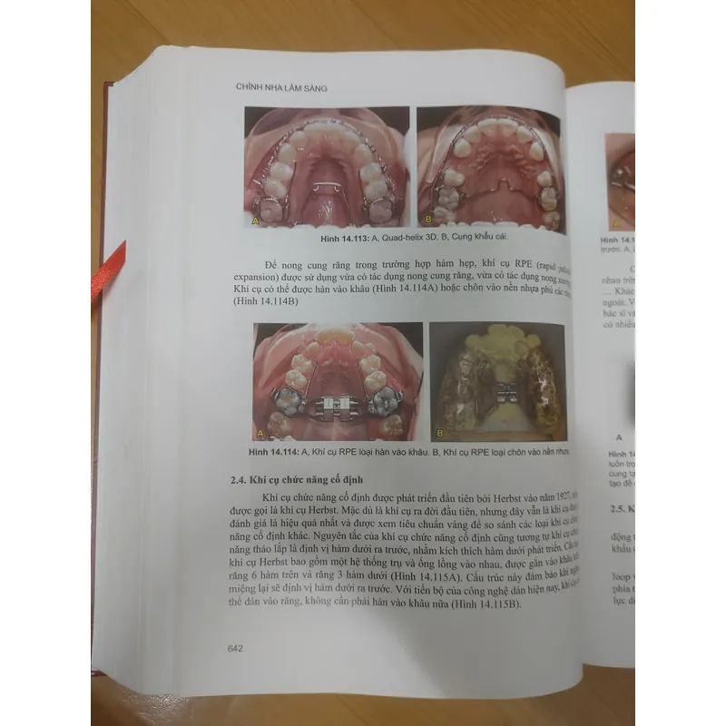 CHỈNH NHA LÂM SÀNG TẬP 1 689476