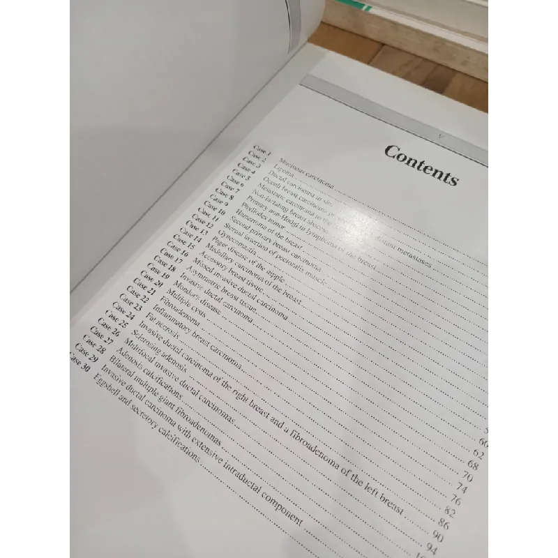 Breast Imaging: A Comprehensive Atlas - Malai Muttarak 703644