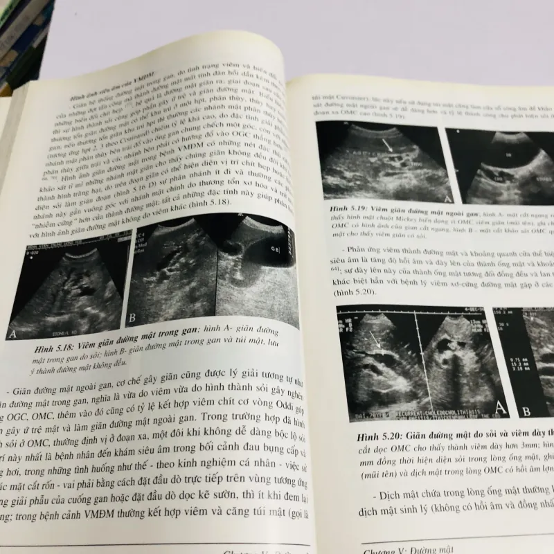 SIÊU ÂM BỤNG TỔNG QUÁT ( Nguyễn Phước Bảo Quân) 780370