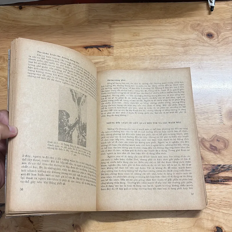 II Sách Y: Bệnh Học _ Bào Thai Và Sơ Sinh (Tập 2) - J. EDGAR MORISON - 1979 682253