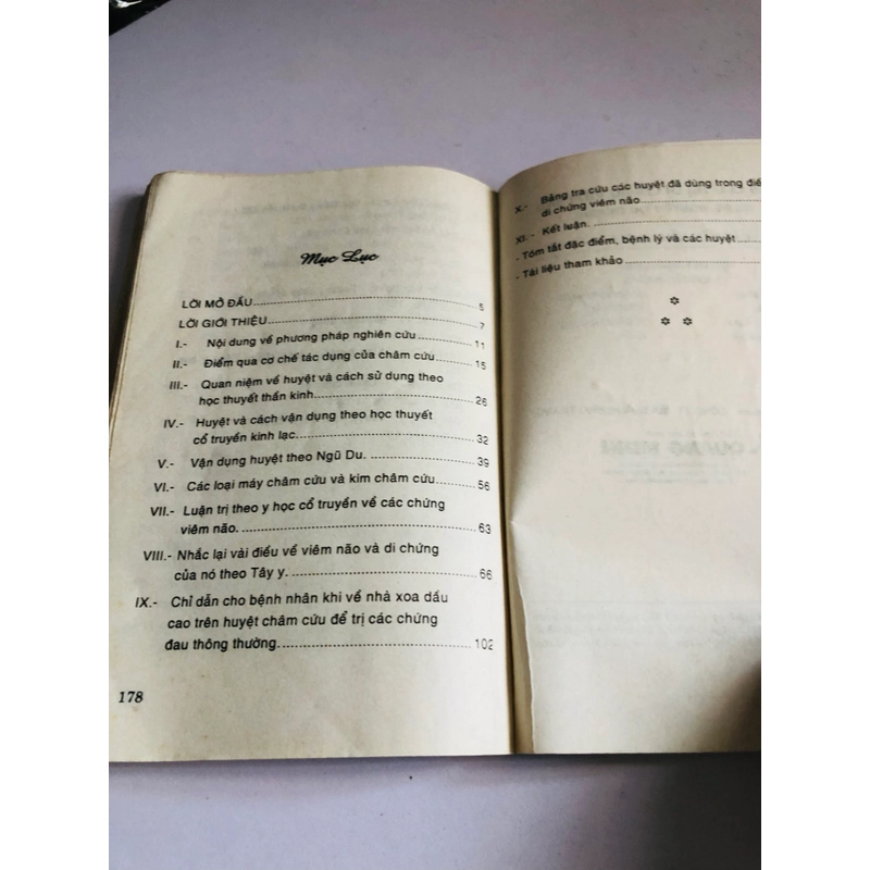 CHÂM CỨU TRỊ DI CHỨNG VIÊM NÃO 548619