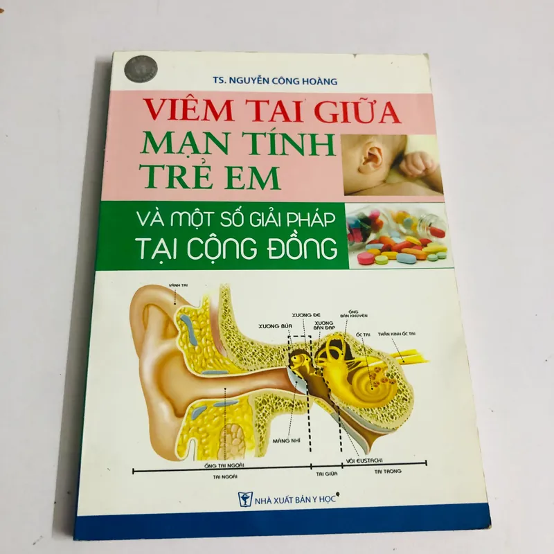 VIÊM TAI GIỮA MẠN TÍNH TRẺ EM  564904