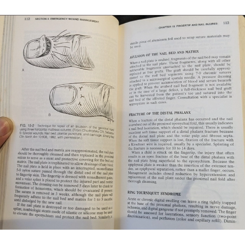 Emergency Medicine a Comprehensive Study Guide 796066