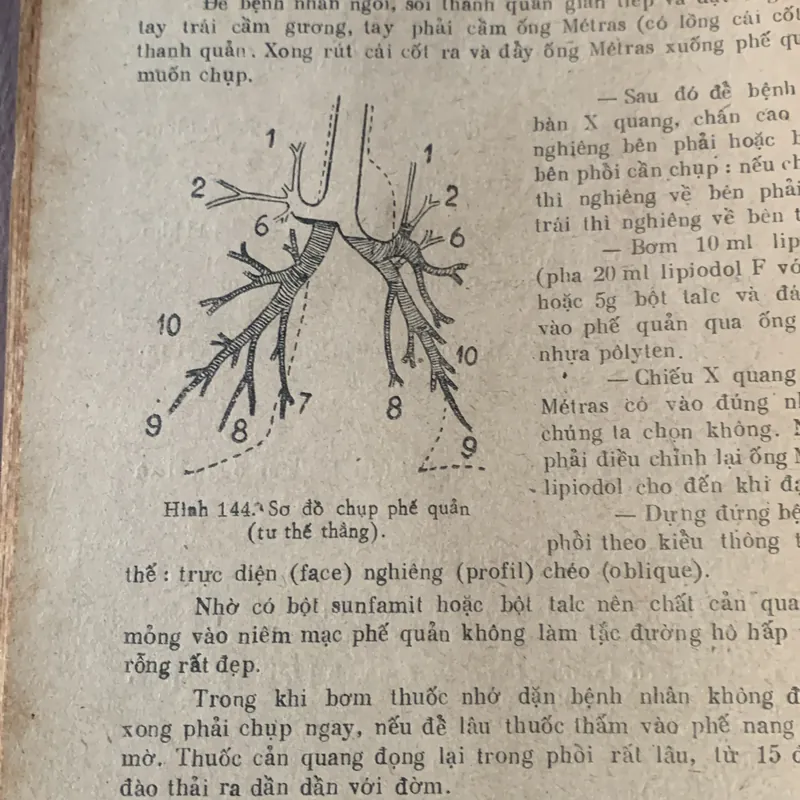 Tai mũi họng thực hành, hình vẽ minh hoạ, Võ Tấn 608499