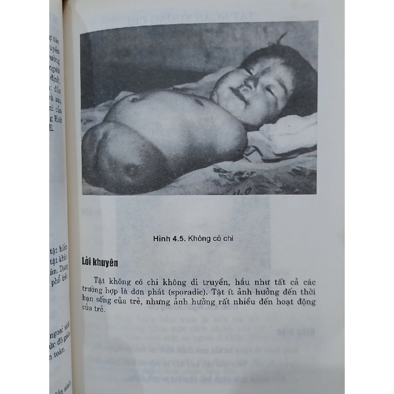 Dị dạng bẩm sinh - GS.TS. Trịnh Văn Bảo 799373