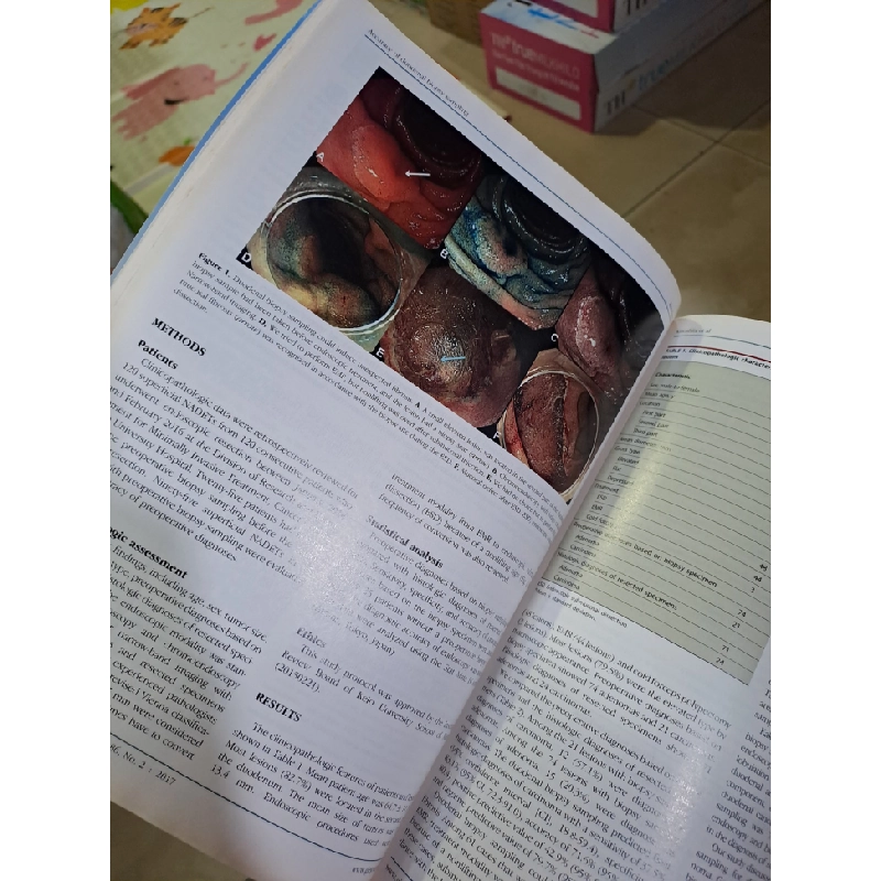 GIE Gastrointestinal Endoscopy volume 86 no 2 8/2017 HCM0808 TẠP CHÍ, THIẾT KẾ, THỜI TRANG 527150