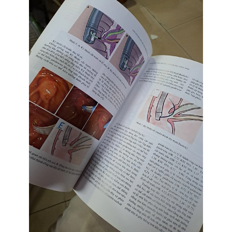 Tạp chí khoa học tiêu hóa việt nam số 68 mới 90% 2022 HCM0808 TẠP CHÍ, THIẾT KẾ, THỜI TRANG 923603