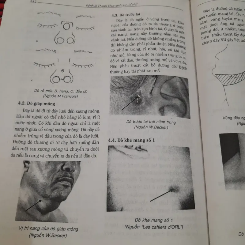 TAI MŨI HỌNG NHẬP MÔN- Phó GS Tiến sỹ NHAN TRỪNG SƠN. 788006