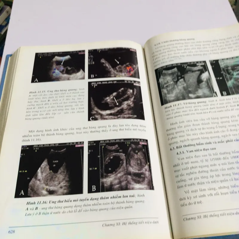 SIÊU ÂM BỤNG TỔNG QUÁT ( Nguyễn Phước Bảo Quân) 780370