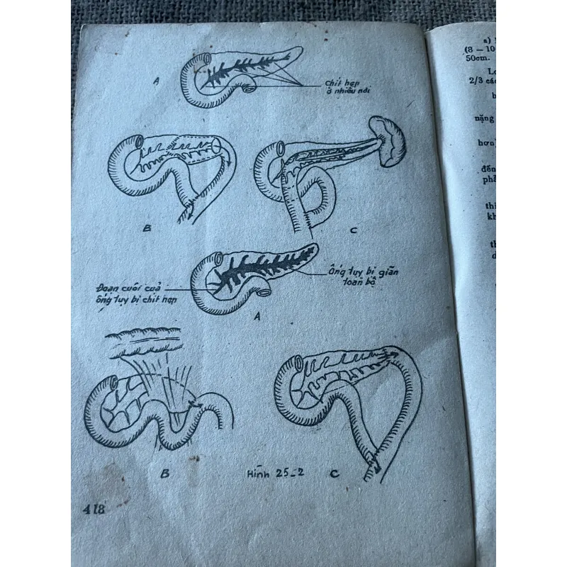 Bài giảng bệnh học ngoại khoa-  tập một tiêu hóa- 1988 789596