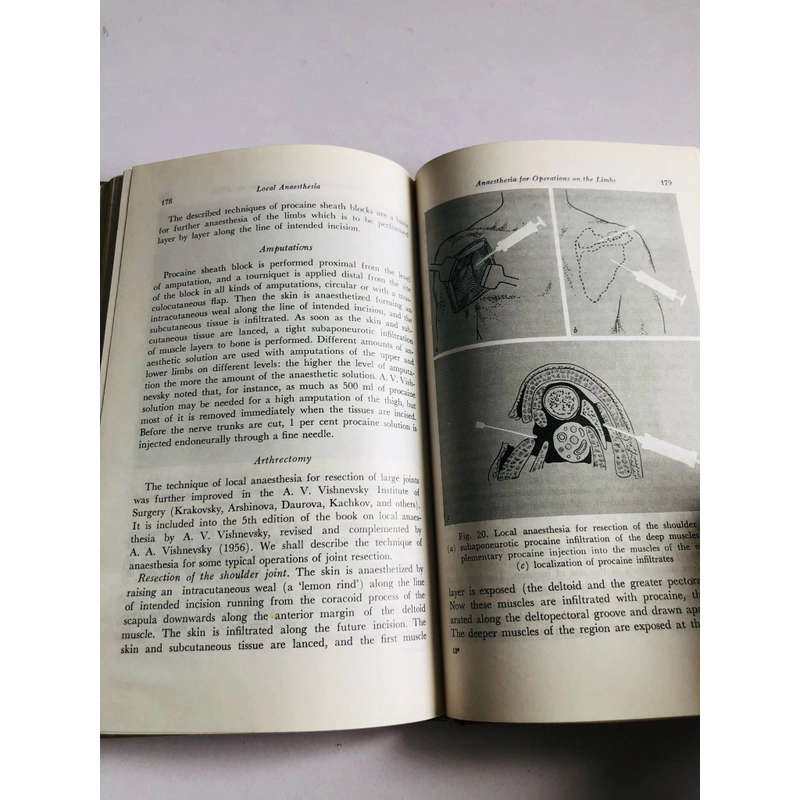 GÂY TÊ TẠI CHỖ  - sách bìa cứng, 226 trang, nxb: 1983 532323