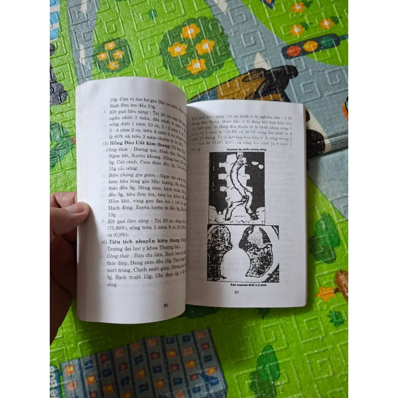 Đông Y Trị Ung Thư: Những Bài Thuốc Đông Y Cho Mọi Nhà 1027665