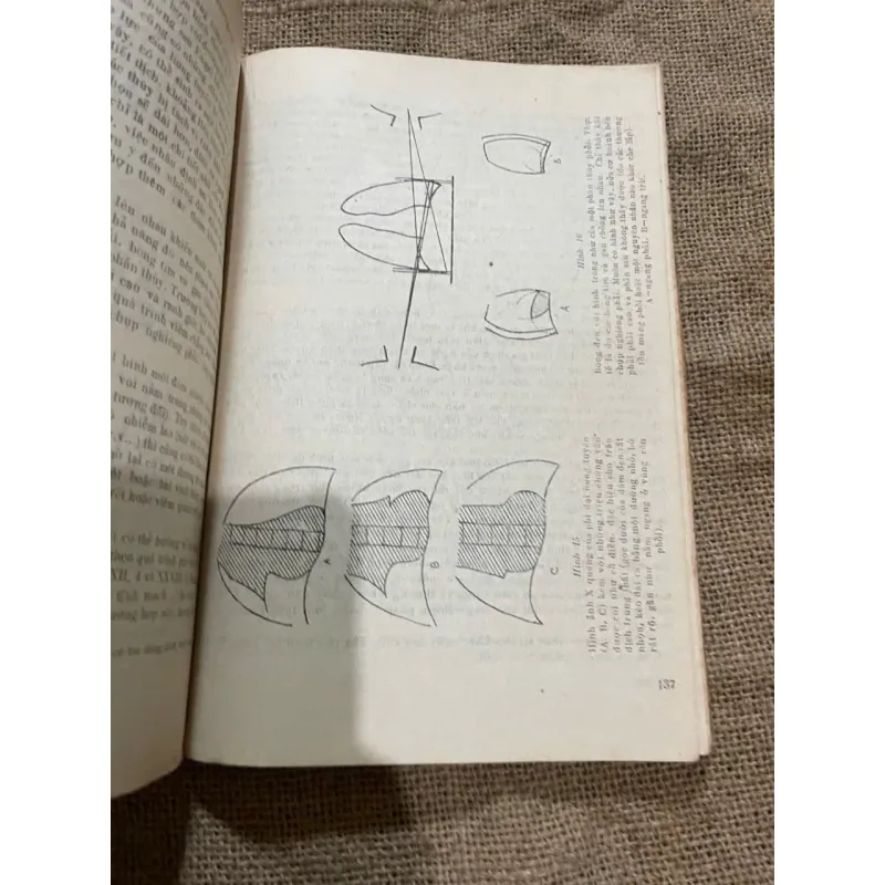 NHỮNG SAI LẦM TRONG CHẨN ĐOÁN BỆNH LAO PHỔI 573053